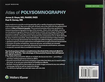 Atlas of Polysomnography: 9781496381088: Medicine & Health